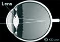 Presbyopia Eye